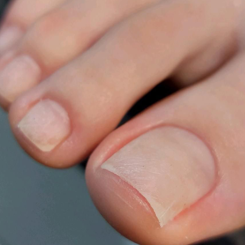 Педикюр подологический