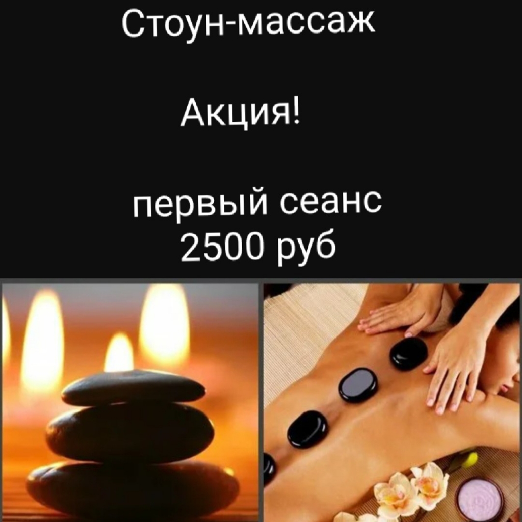 Стоун-терапия