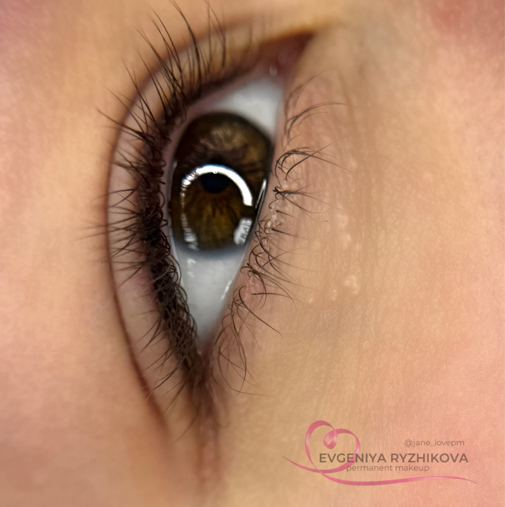 👁 МЕЖРЕСНИЧКА