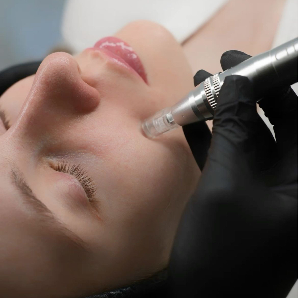 Аппаратная мезотерапия лицо+шея+декольте