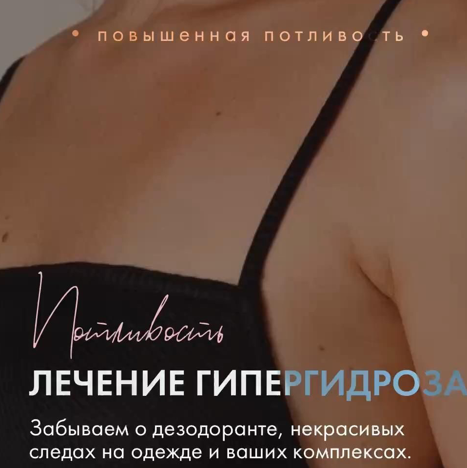 Гипергидроз