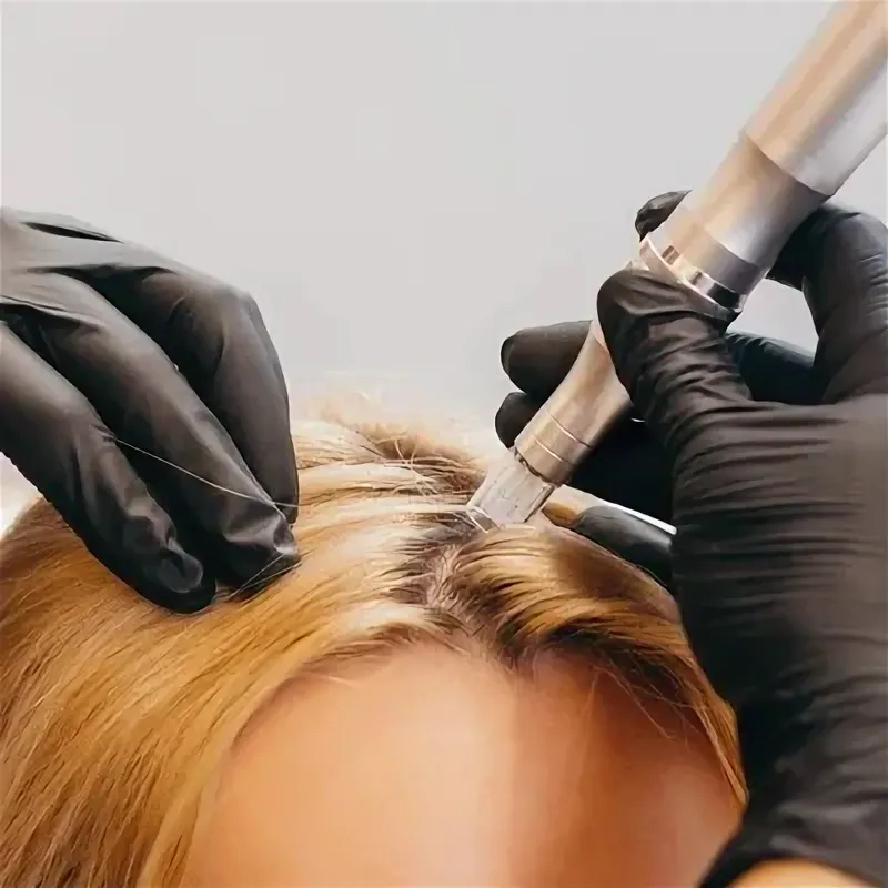 Фракционная мезотерапия головы