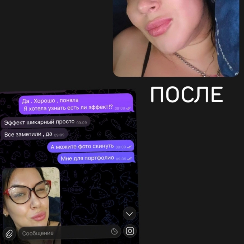 Липолитик пептидный по типу "Стройность "