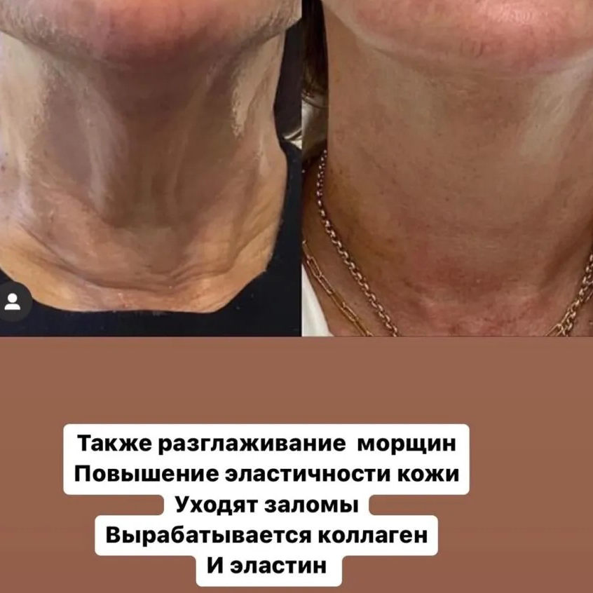💙Морфеус8     

✔️Лицо+ второй подбородок + шея+ декольте   “STRONG”