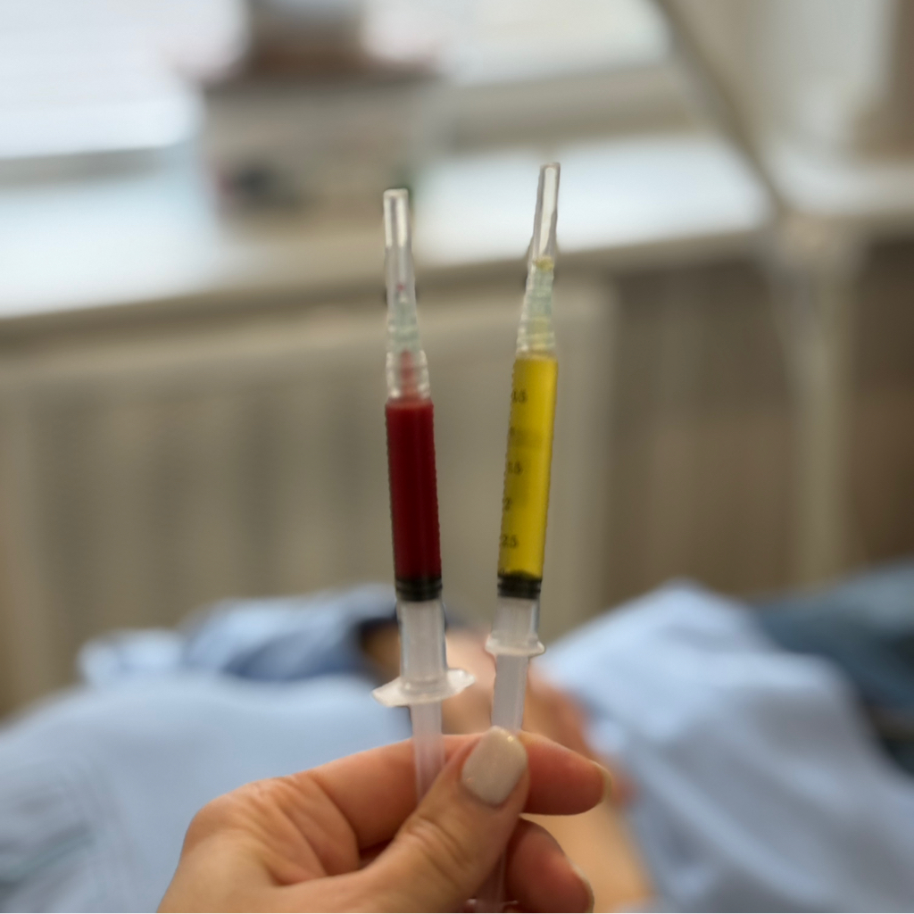 Плазмотерапия Cortexil prp