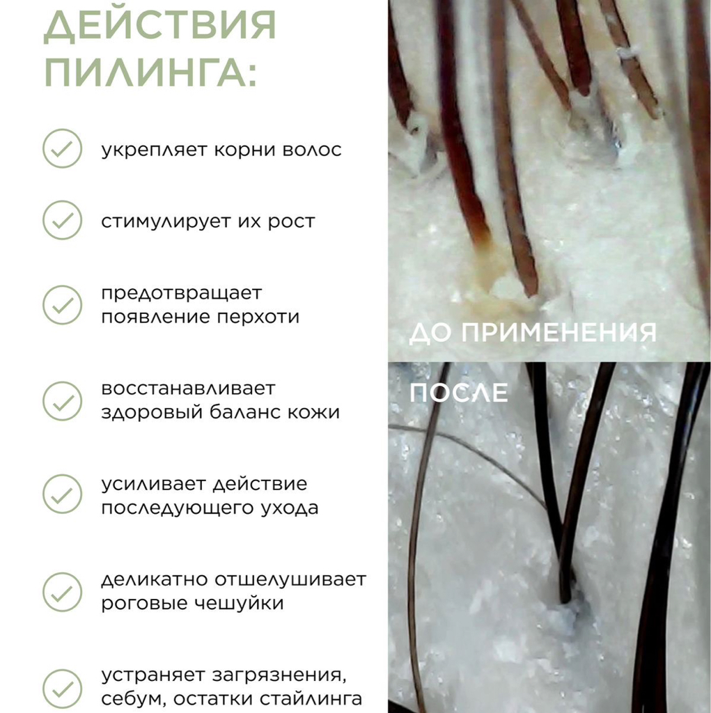 Пилинг кожи головы
