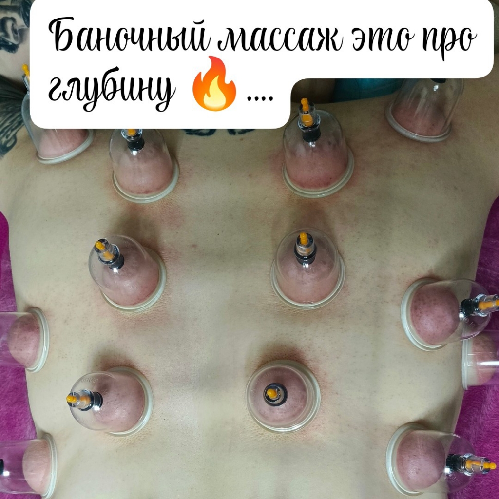 баночный массаж спины