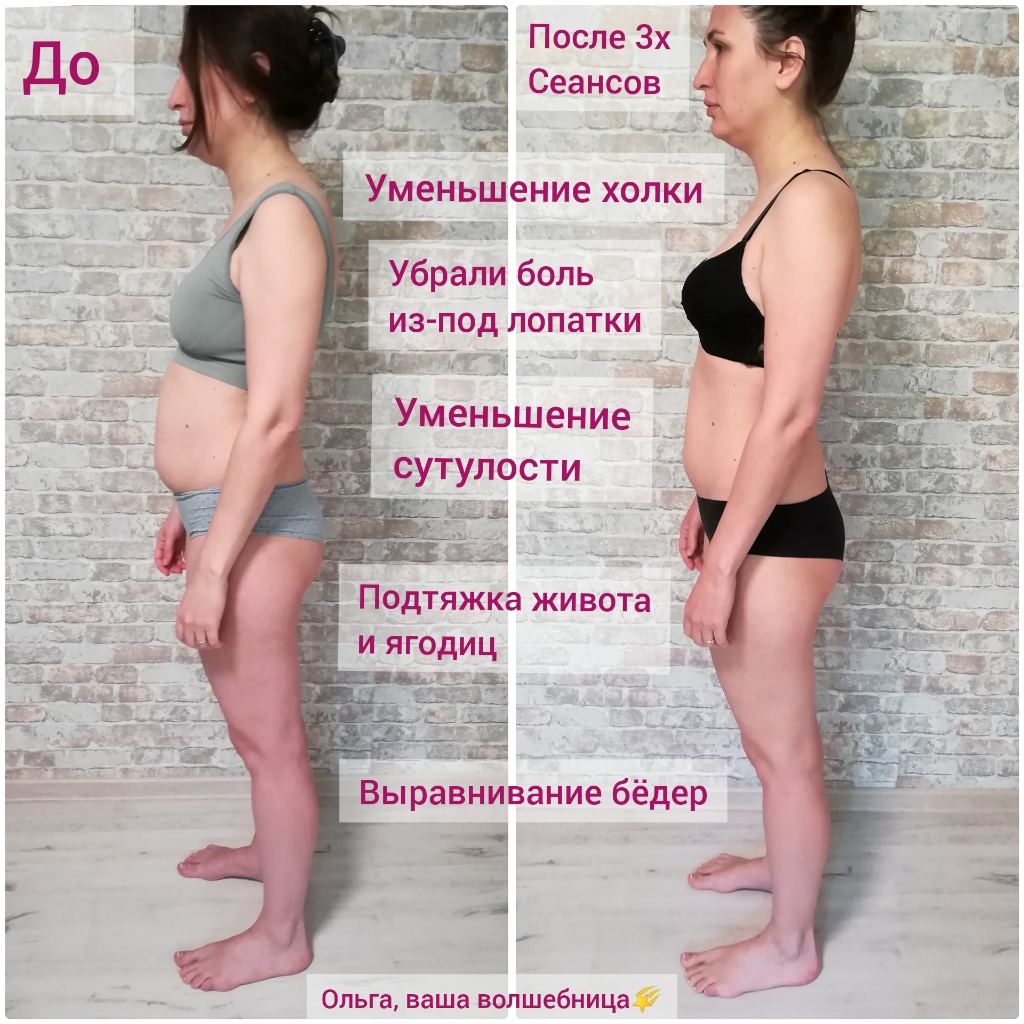Миофасциальный массаж тела