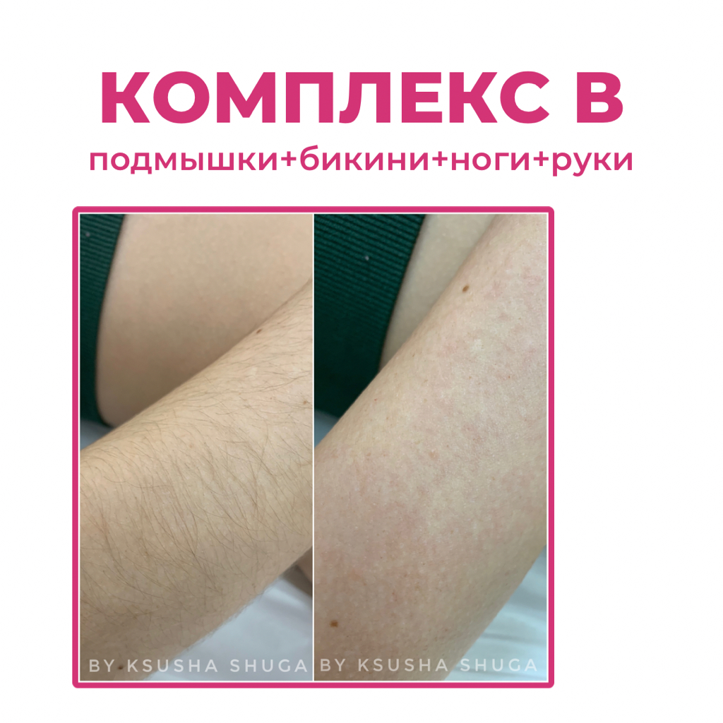 Комплекс В (подмышки+бикини+ноги+руки)