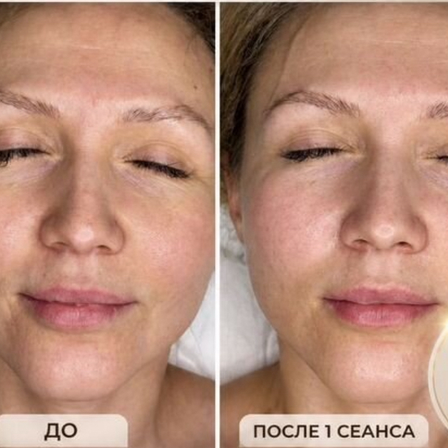 Первая пробная процедура  Массаж лица