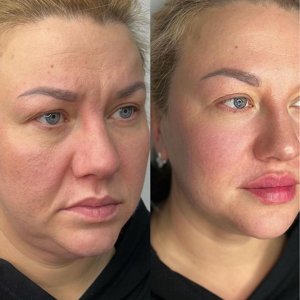 Full face