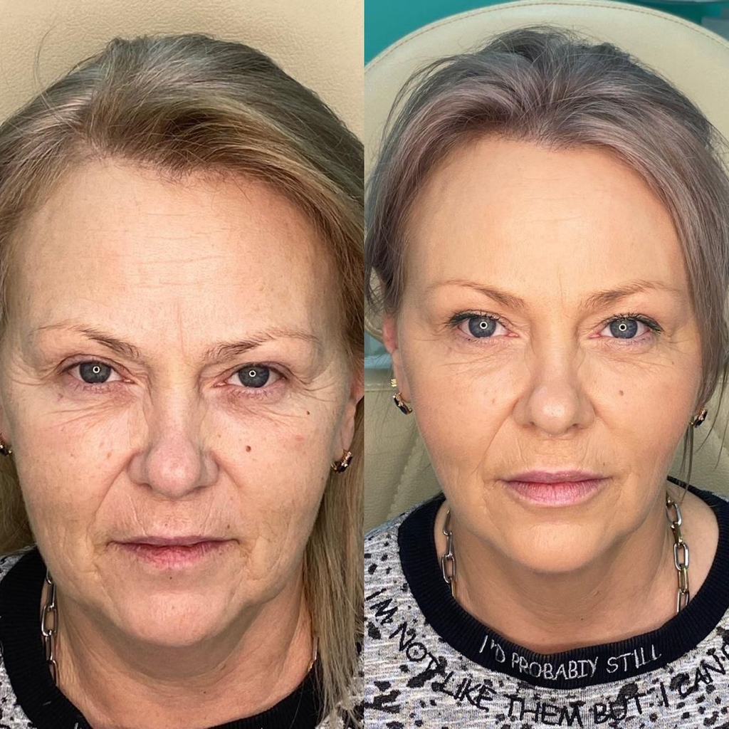Все лицо Full Face (без шеи)