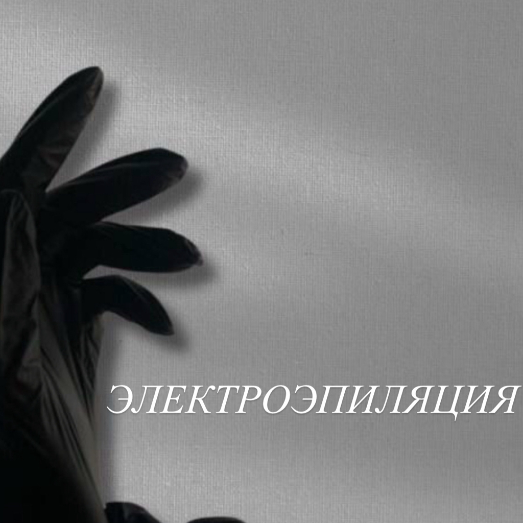 Электроэпиляция