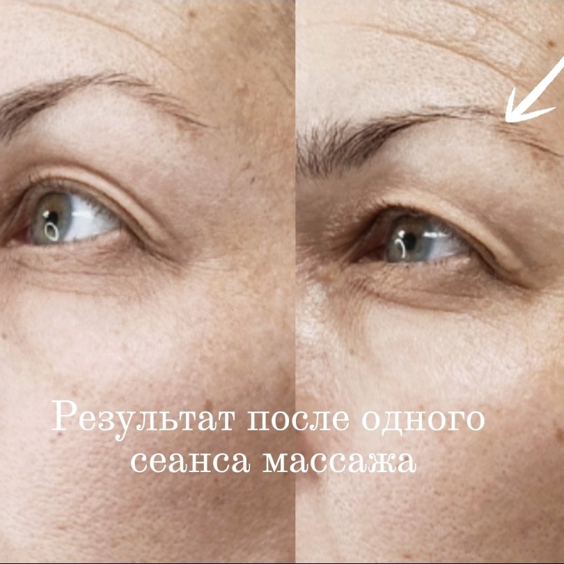 Массаж лица