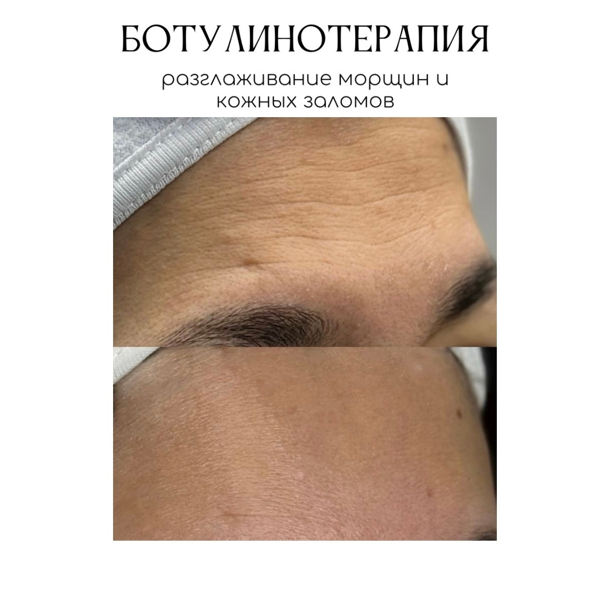 Релатокс