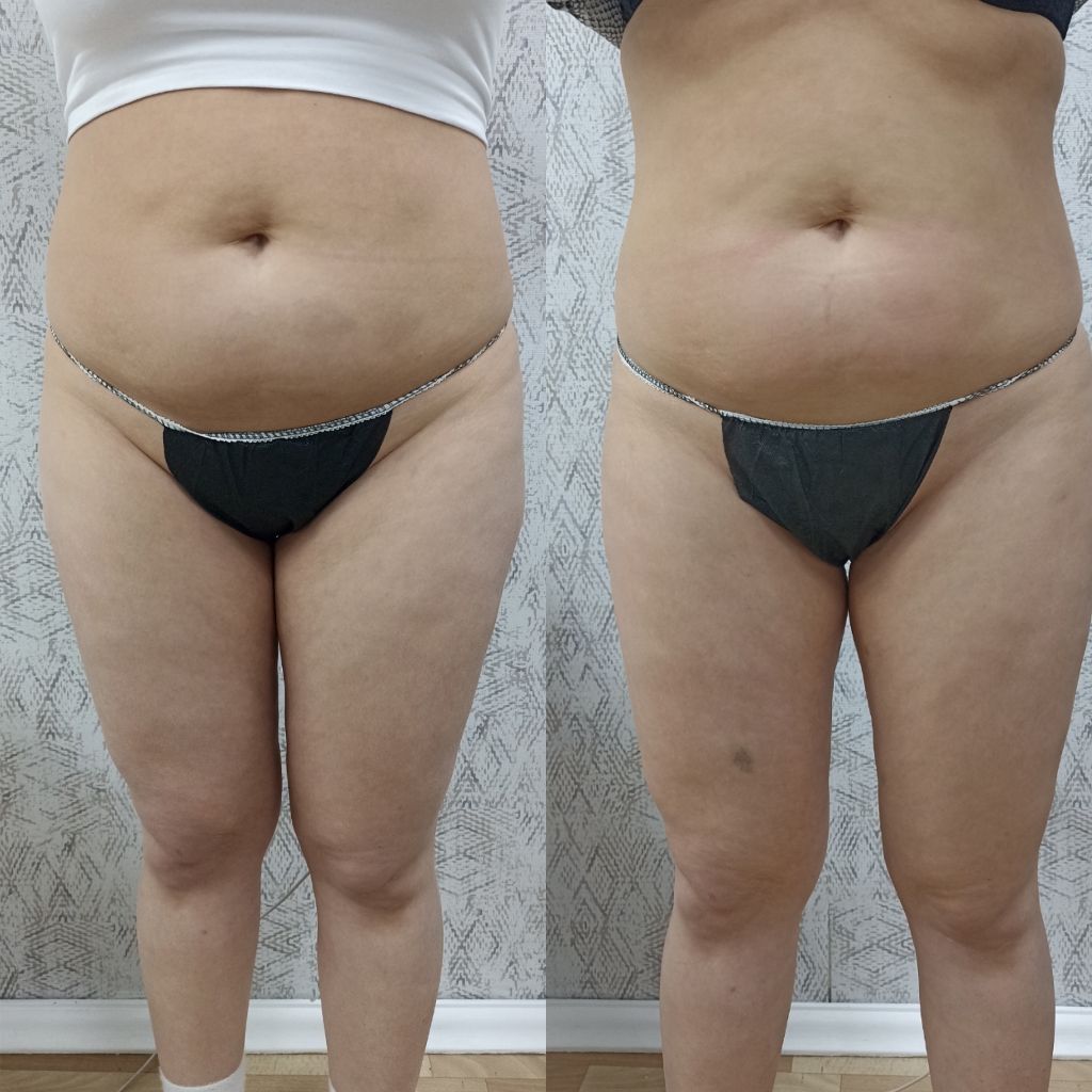 Кавитация