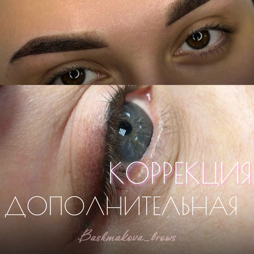 Дополнительная (вторая коррекция)