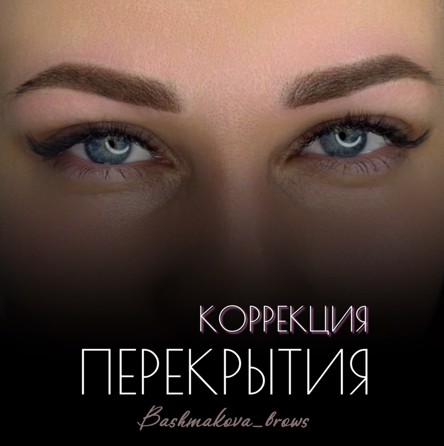 Коррекция перекрытия (через 1-2 месяца)