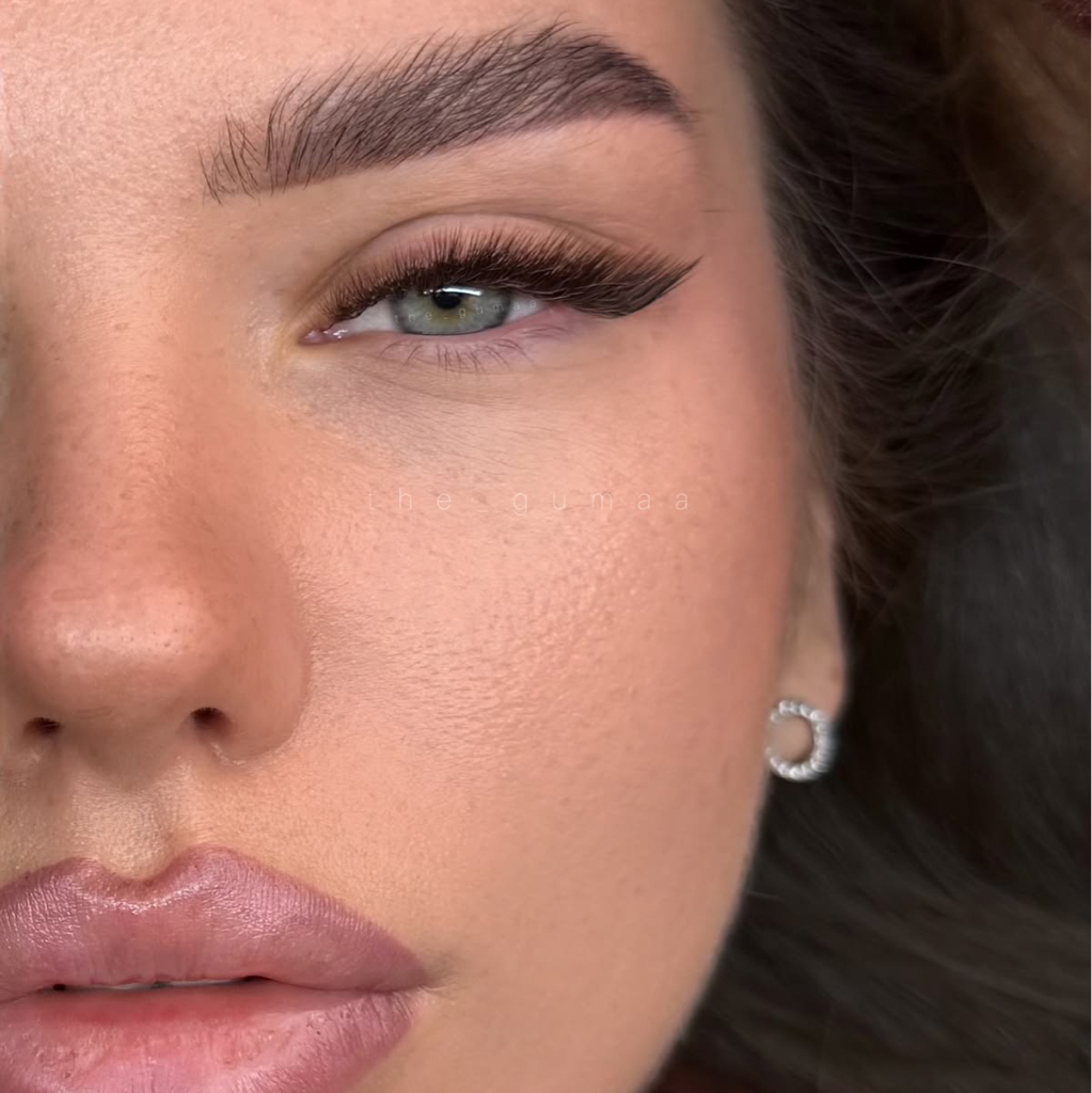 3D