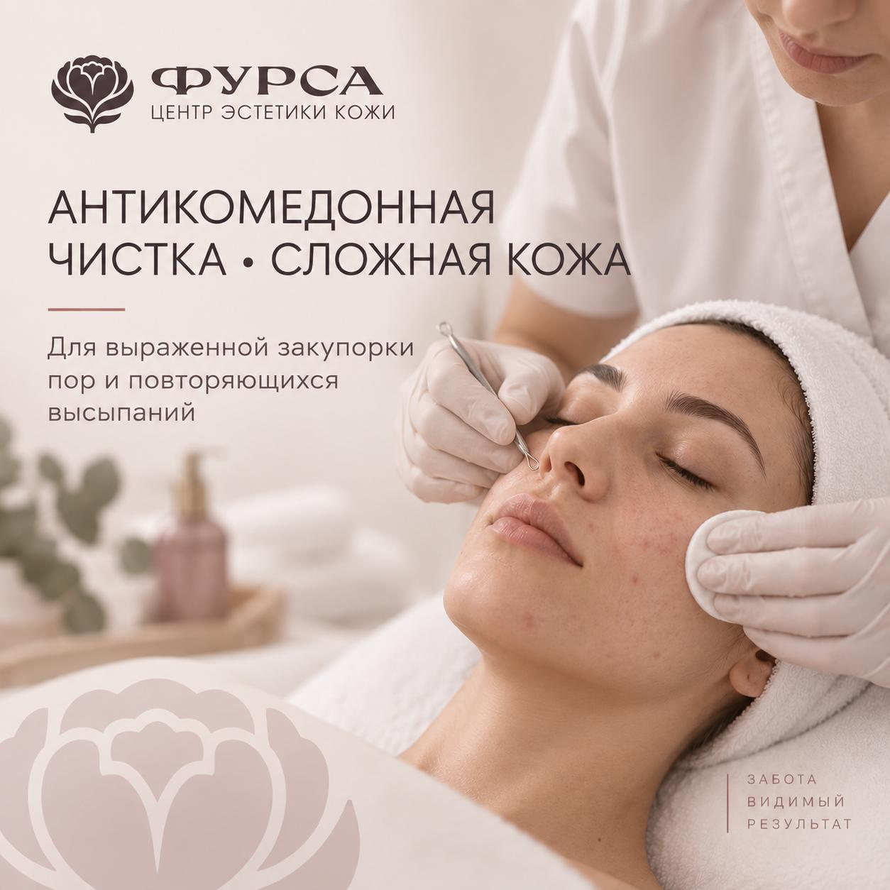 Антикомедонная чистка • сложная кожа • глубокое очищение без лишней травматизации