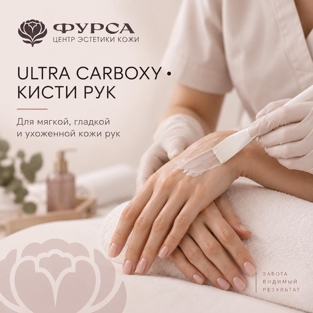 Ultra Carboxy • кисти рук • гладкость и ухоженный вид кожи