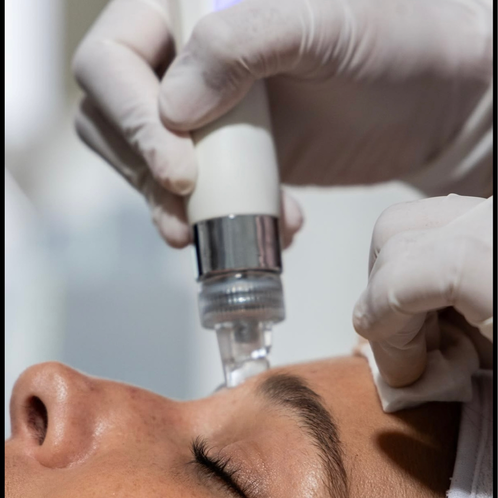 HydraFacial (гидропилинг)