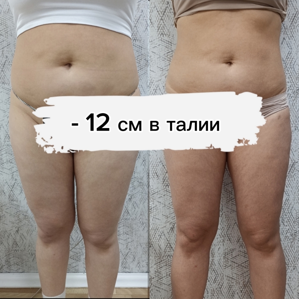 Вибромассаж